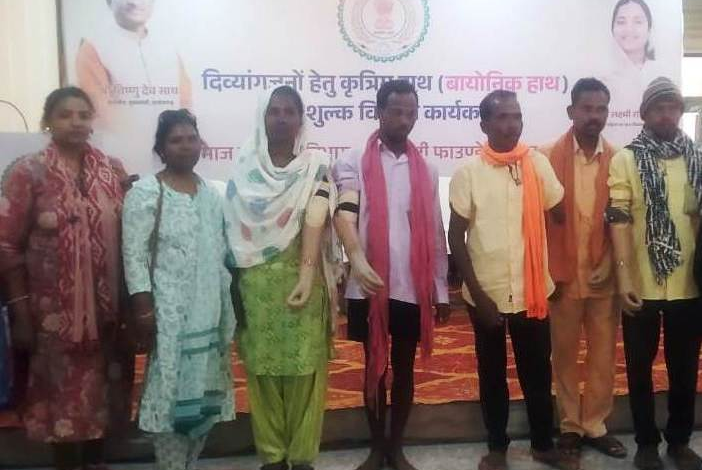 रायपुर : दिव्यांगजनों को मिला बायोनिक कृत्रिम हाथ…